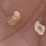 Fruit of the Limeum arabicum flora